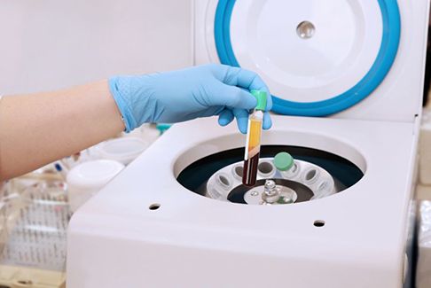 Gloved hand removing vial of blood from centrifuge