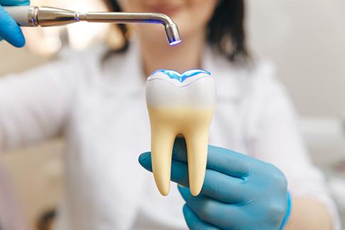 Dentist demonstrating dental bonding on large model tooth