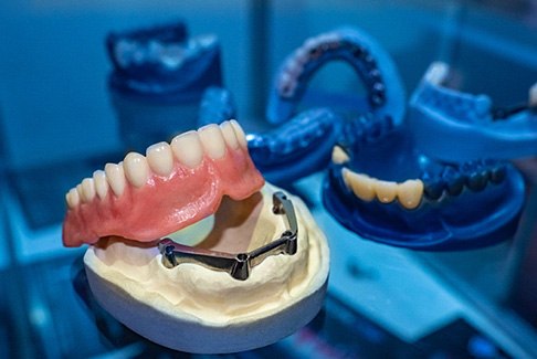 implant dentures on table