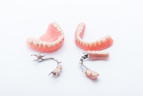 Four types of dentures