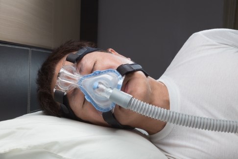 Man sleeping with CPAP system before oral appliance therapy for sleep apnea