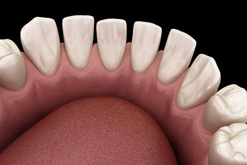 An illustration of gapped teeth