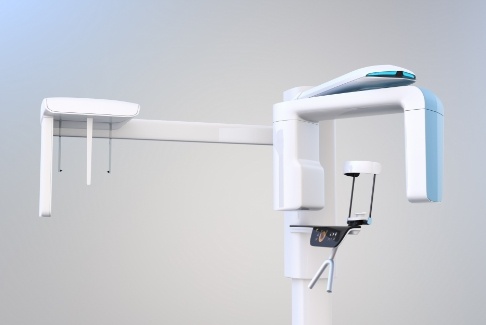 3 D C T cone beam digital x-ray scanner