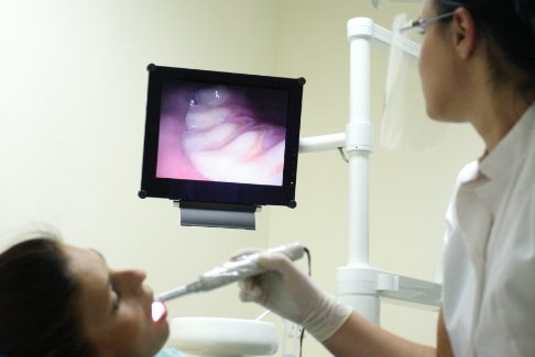 Dentist using early cavity detection system