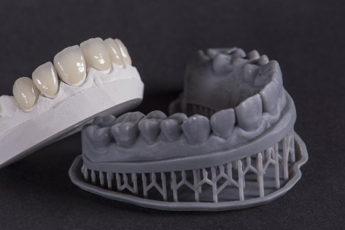 Model of 3 D printed teeth